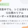 シミ取りレーザー経過写真12日間