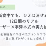 シミ取りレーザー経過写真12日間