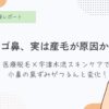 毛穴、小鼻の黒ずみ、イチゴ鼻、医療脱毛、永久脱毛、光脱毛、産毛、顔面脱毛、50代